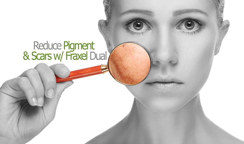 Fraxel 1927 Laser For Pigment Toronto
