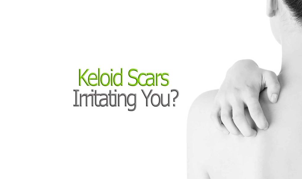 Keloid Scar Removal in Toronto Hero Banner