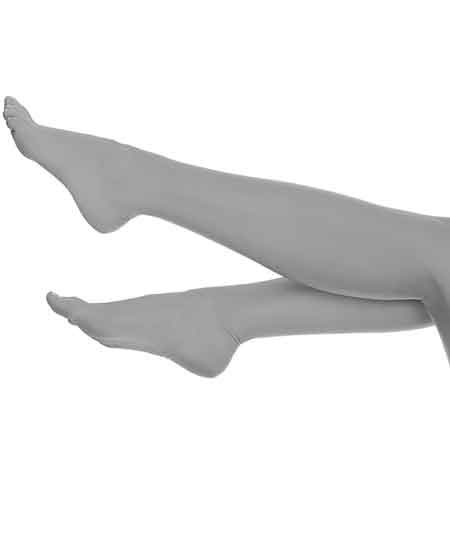 Spider Vein Laser Removal Treatment Toronto