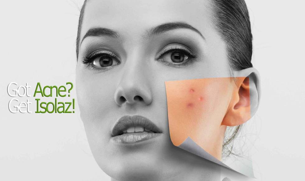 Isolaz Acne Treatment toronto