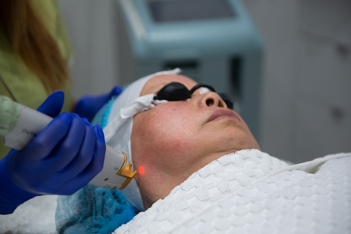 Laser Genesis Toronto Treatment
