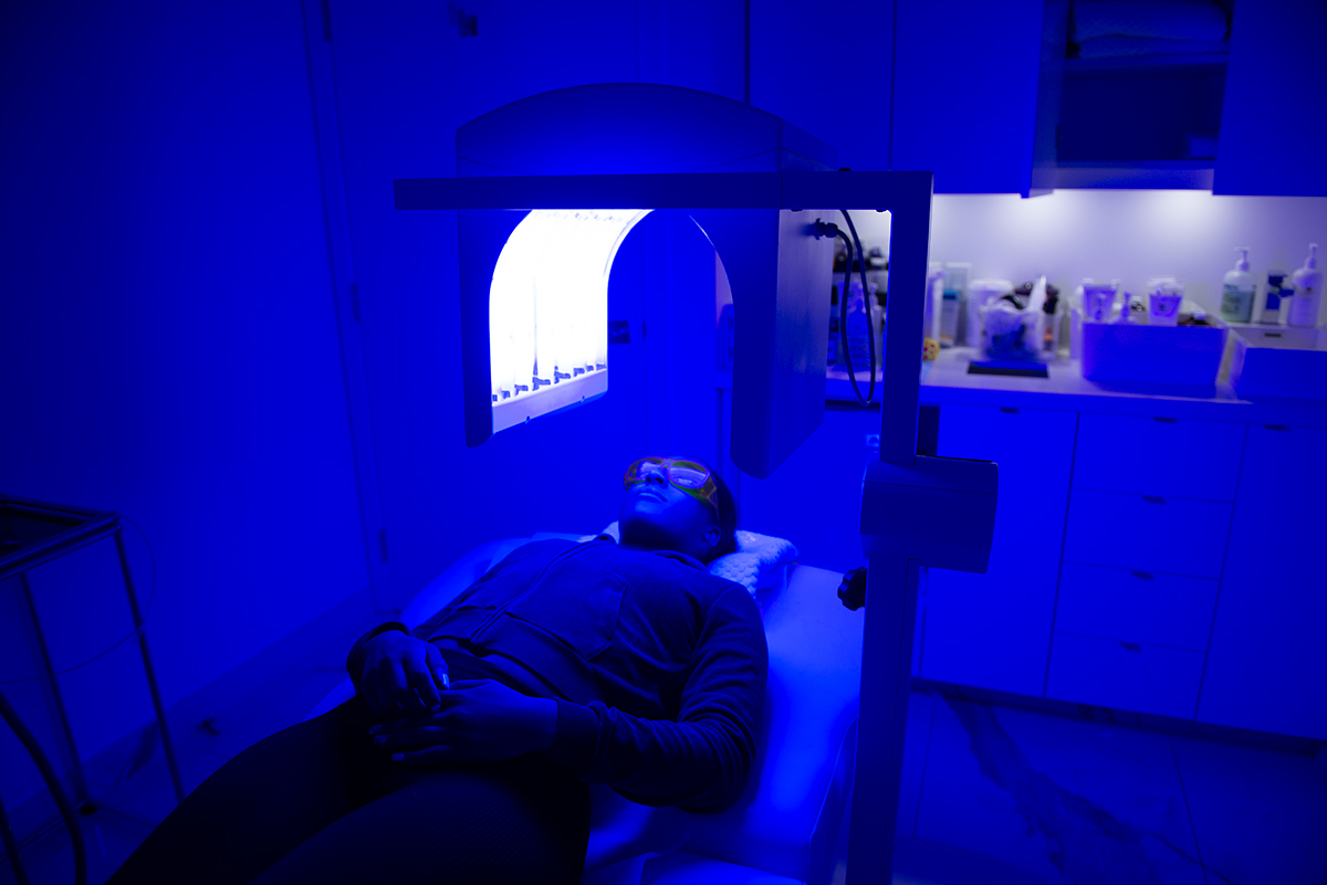 Isolaz Acne Treatment toronto