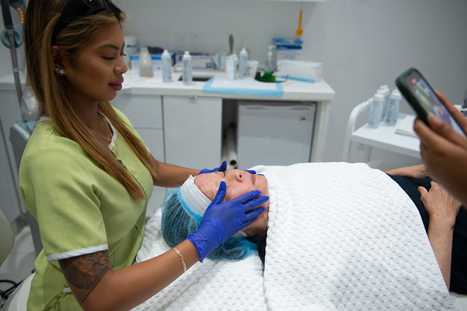 Microdermabrasion Toronto Treatment