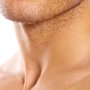 Front Of Neck Laser Hair Removal pkgs