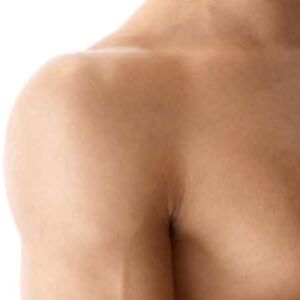 Shoulders Laser Hair Removal pkgs