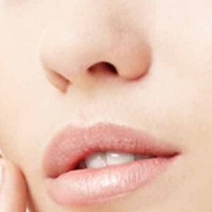 Upperlip Laser Hair Removal pkgs
