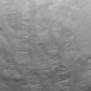 Carboxytherapy Buttock