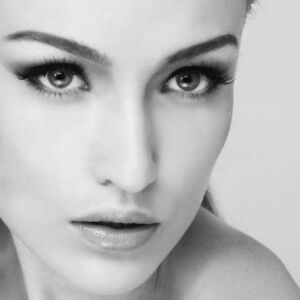 Thermage Eyes, Including Eyelids