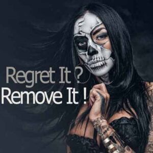 Tattoo Removal 8″ x 8″ Area pkgs