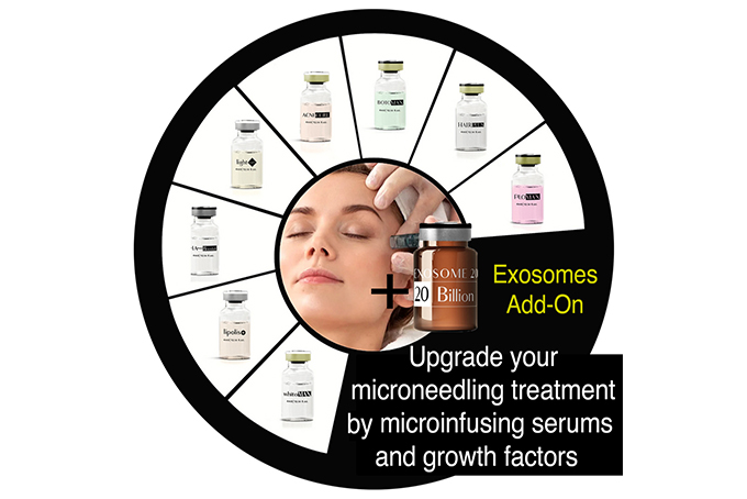 Laser Genesis Treatment