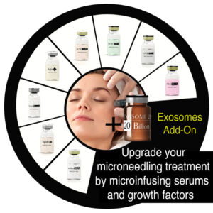 Add on Exosomes (no needling)
