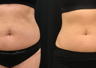 Evolve Before After 4