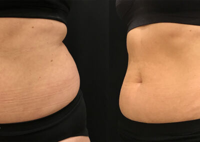 Evolve Before After 5