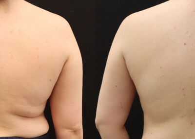 Evolve Before After 6