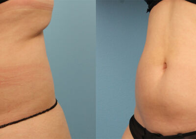 Evolve Before After 7