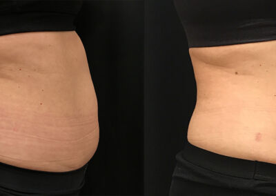 Evolve Before After 1