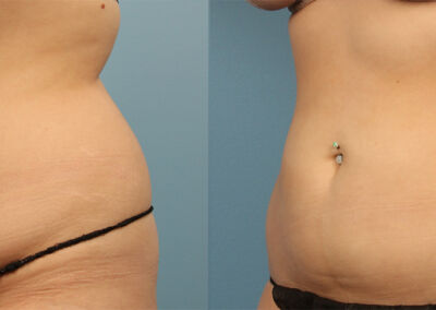 Evolve Before After 8