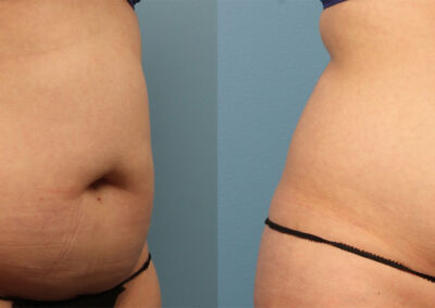 Evolve Before After 9