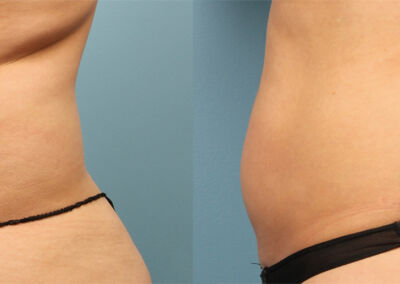 Evolve Before After 10