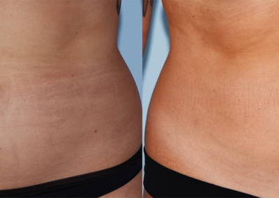 Evolve Before After 3