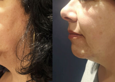 Morpheus Before After 12