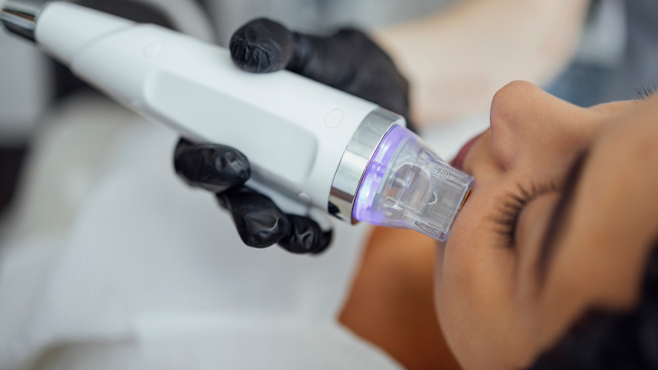 ThermaFrac Exosome 4D Treatment Banner