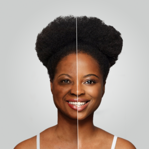 Pigmentation Reduction Bundle For skin types 4-6 (Fitzpatrick scale)