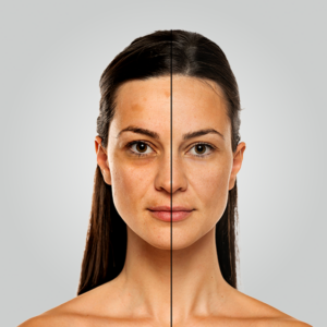 Pigmentation Reduction Bundle For skin types 1-4 (Fitzpatrick scale)