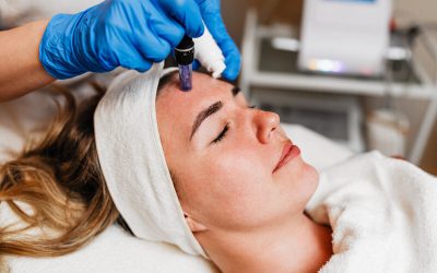 Microneedling vs. Chemical Peels: Which One Is Better?